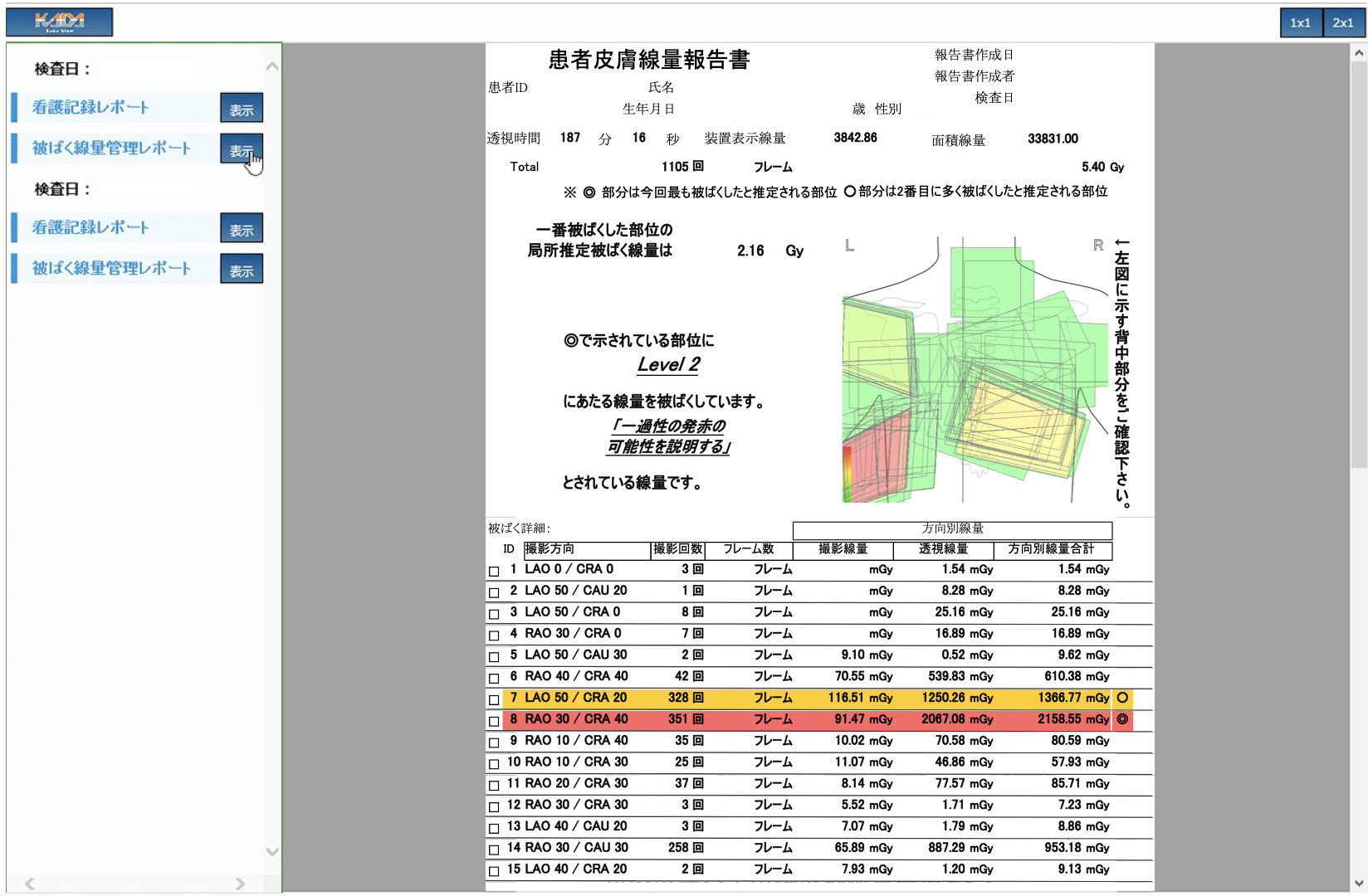図3-2　皮膚被ばく線量マップ（２）